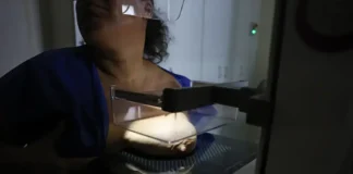 ANS defende que plano cubra mamografia digital sem restrição de idade