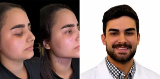 Dr. Bruno Tampelli amplia atuação e traz cirurgias estéticas da face para Extrema e região